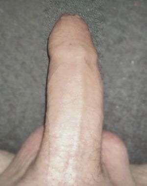 My penis