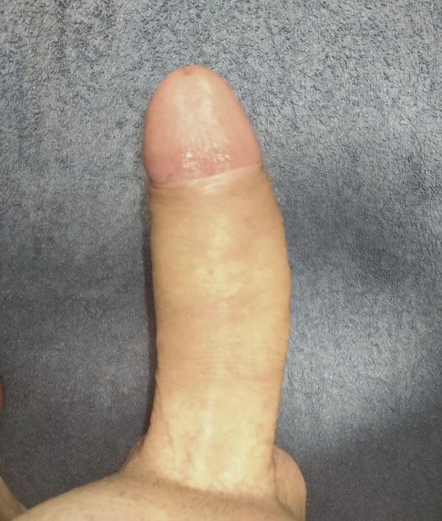 Dick