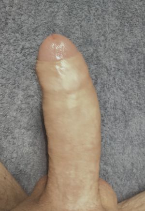 Uncut penis