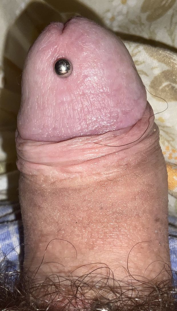 Hg