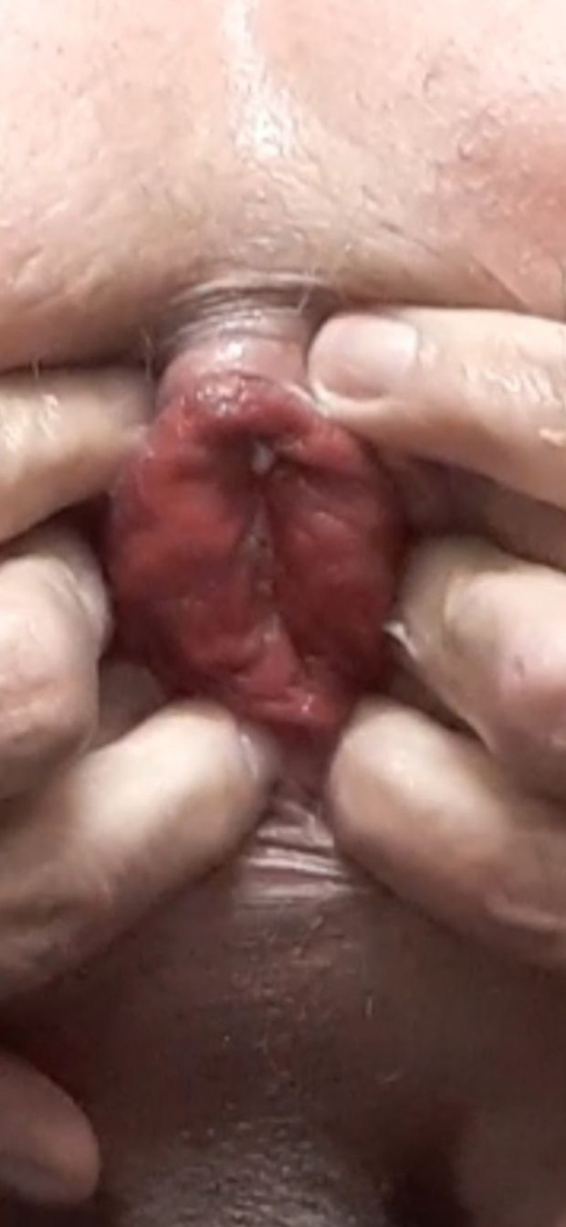 If Only I Could Eat My Own Butthole