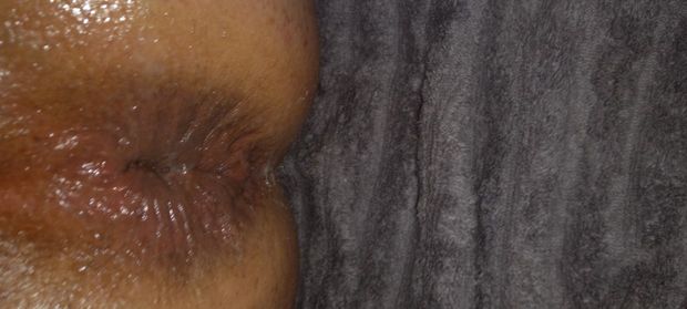 My Worn Out Used Butthole