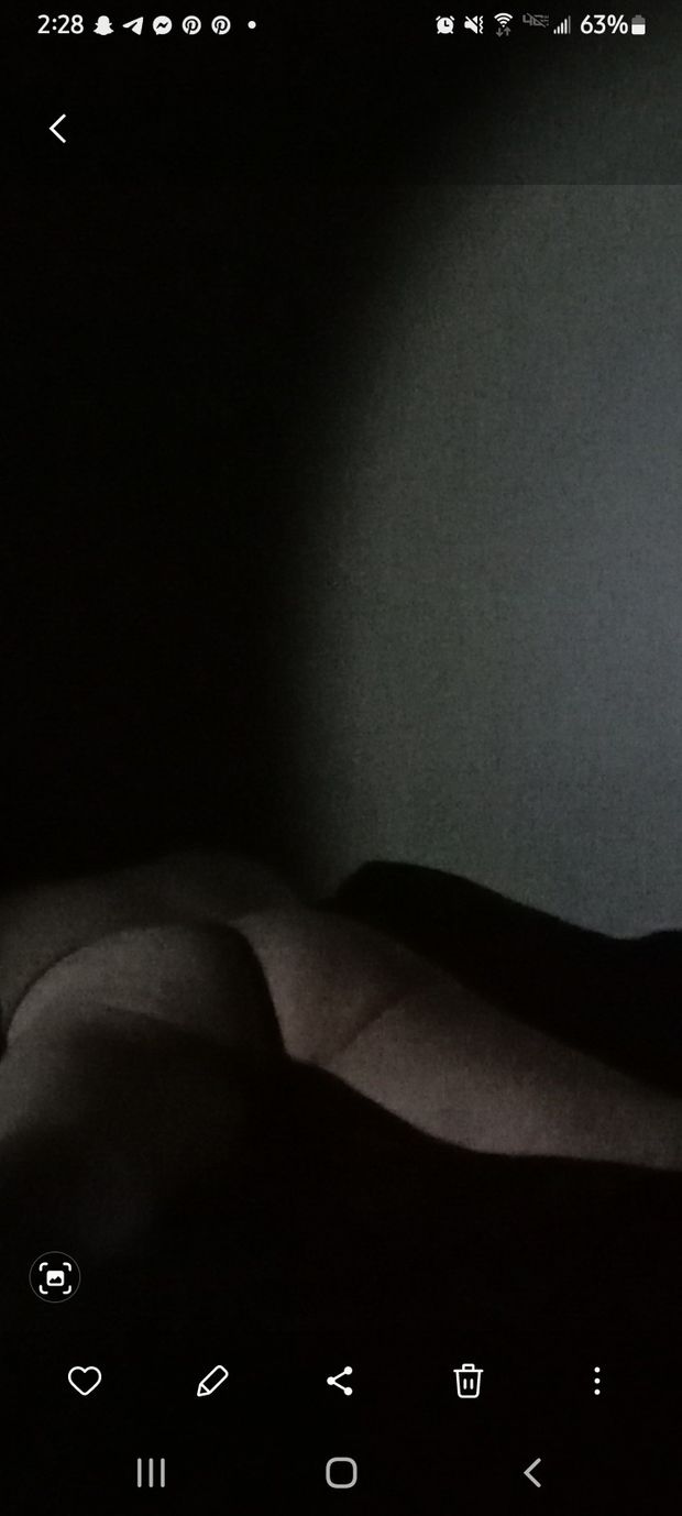 Prostate ass