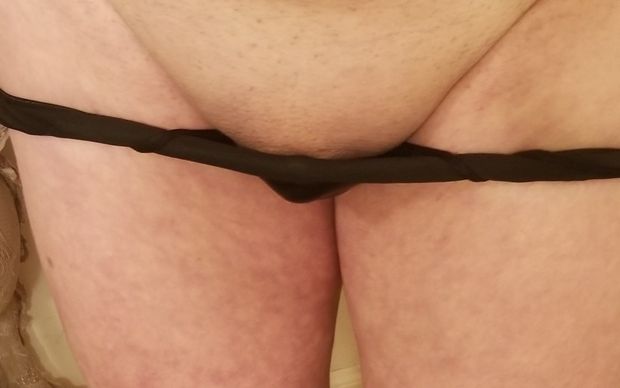 Miniature micropenis