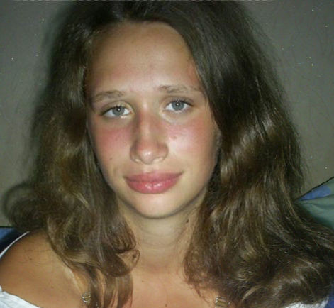 My face