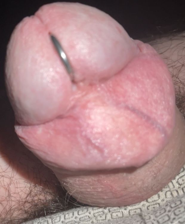 Lindo