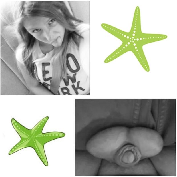 nega man boobs penis starfish discretion lawsuit with zoie williams yang