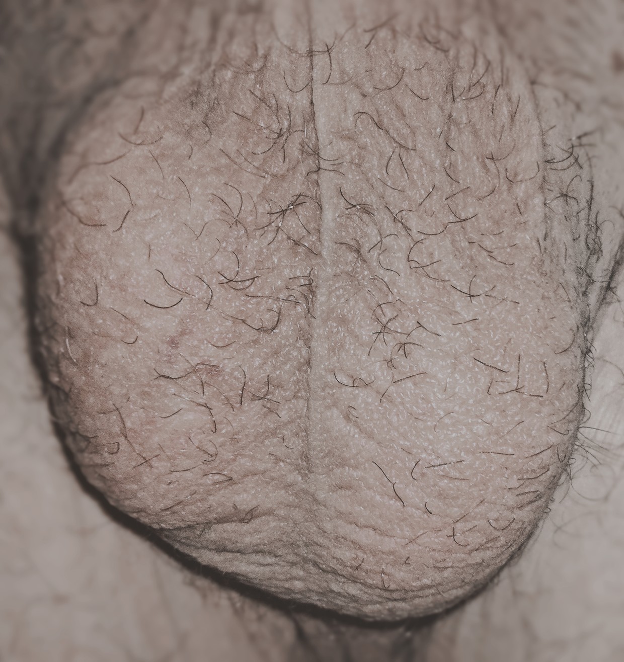 My balls