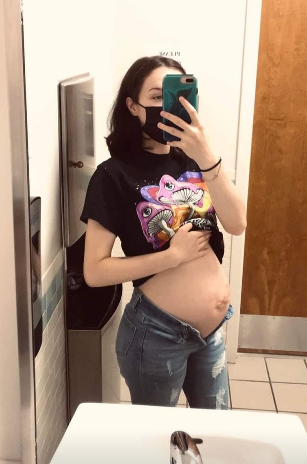 Pregnant with no belly button