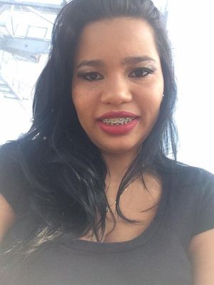 Brazilian Teen Brunette Beautiful Smile Braces Metal
