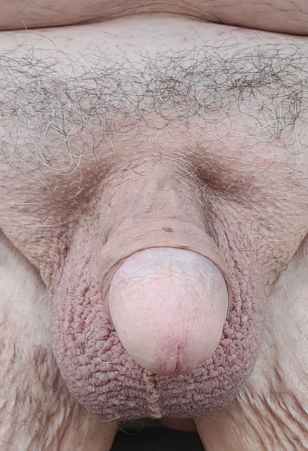 Double cock rings not showing