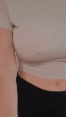 Braless nipples