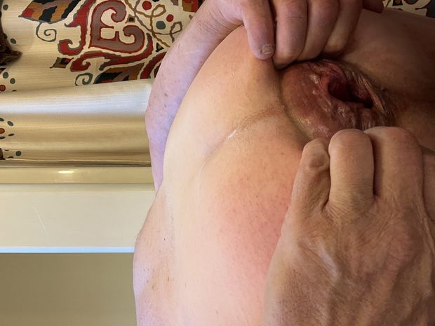 Amazing gape, working on prolapse