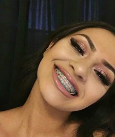 latina braces