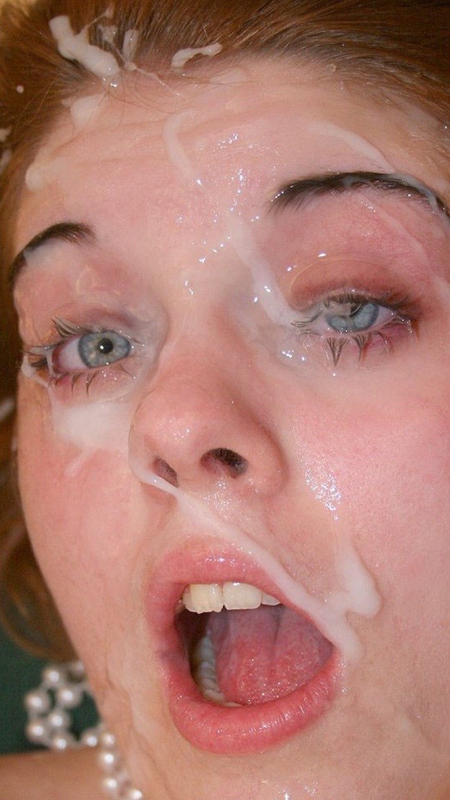 pinkeye