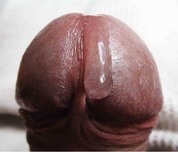 Lick it
