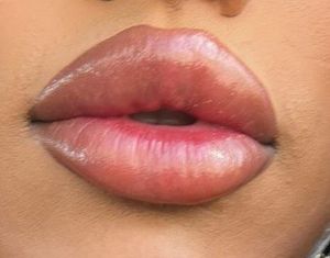Phenomenal Lips Of Jeremy