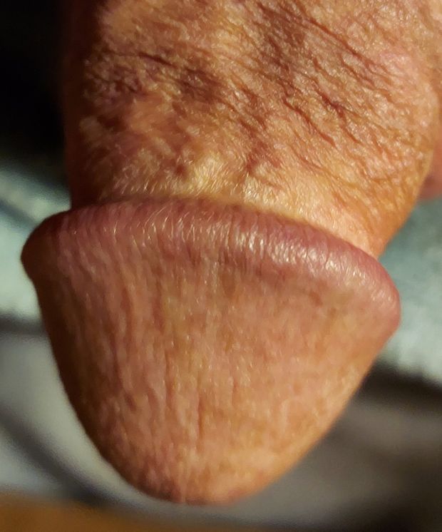 Head of my cock.