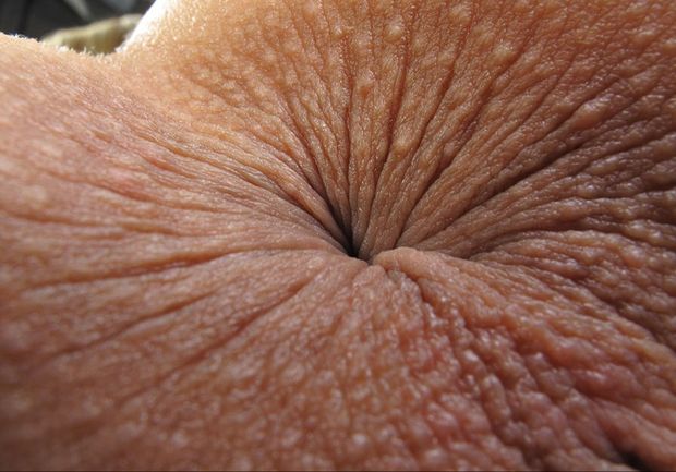 Tight butt hole