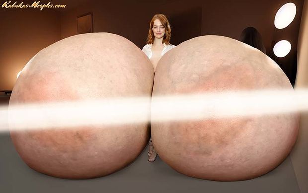 Emma Stone Exposing Her New Giant Silicone Tits