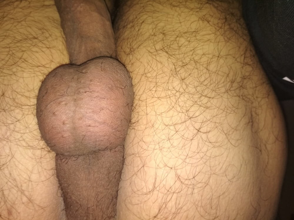 Clitoris