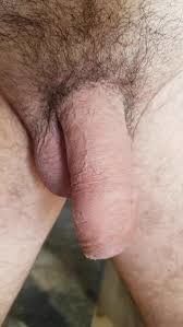 Foreskin needs a mouth