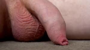 Flabby, flaccid, foreskin needs excitement