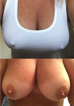 gorgeous mature breasts covered and exposed