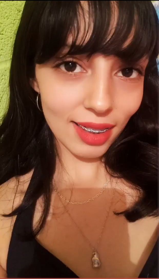 Linda Braces