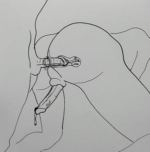 Anal drawing