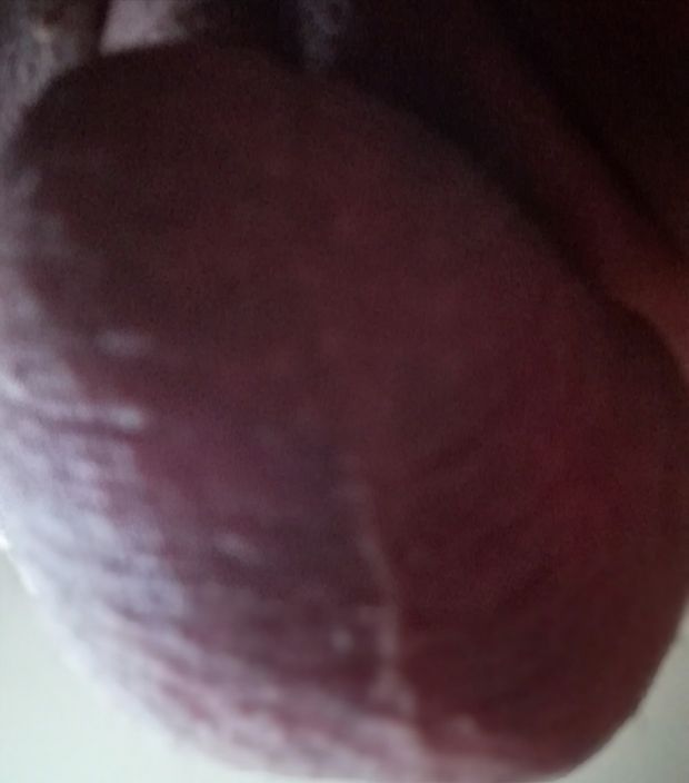 Me balls