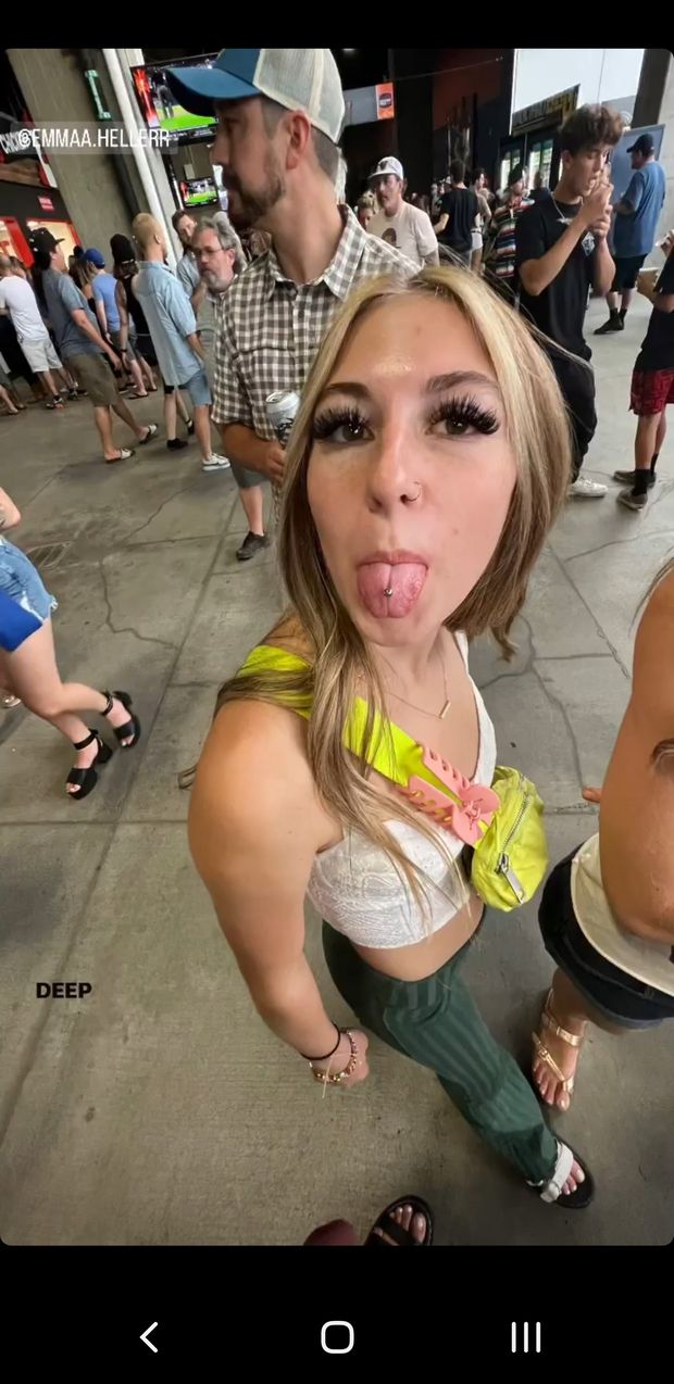 Nut on teenager