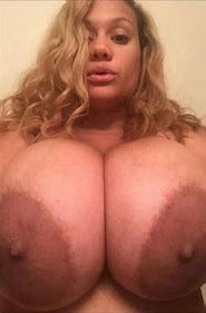 Huge dark areolas