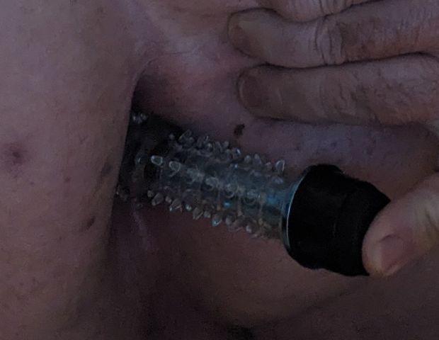 Anal