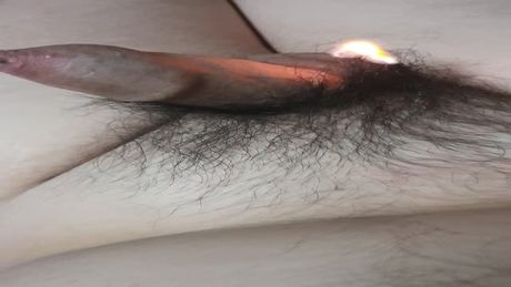 Burn penis hair