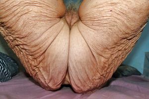 wrinkly old ass