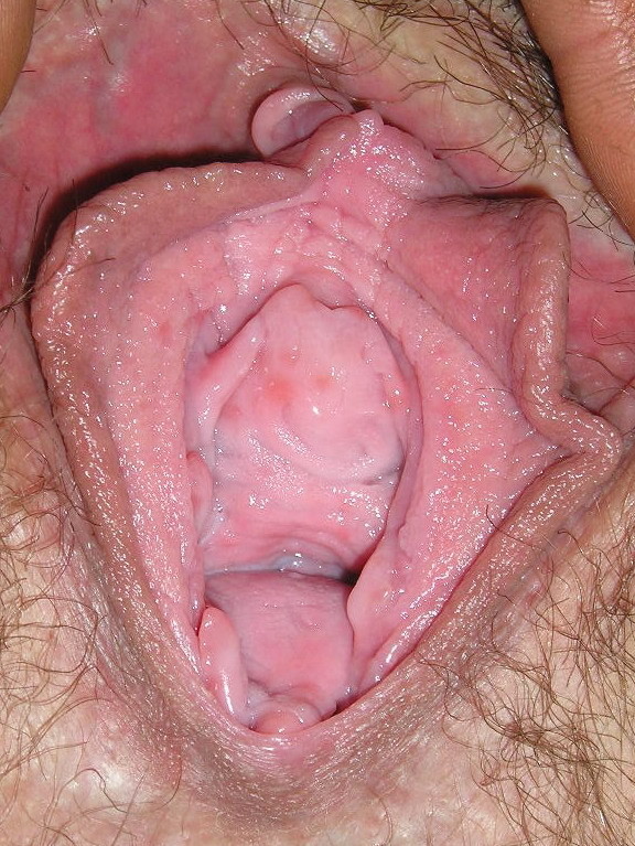 wide open