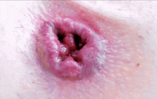 open your ass