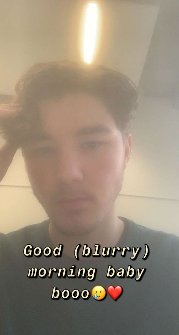Blurry camera