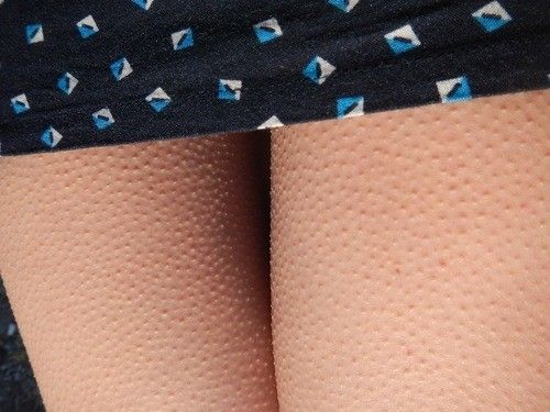 Anticipation...