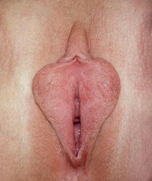 labia