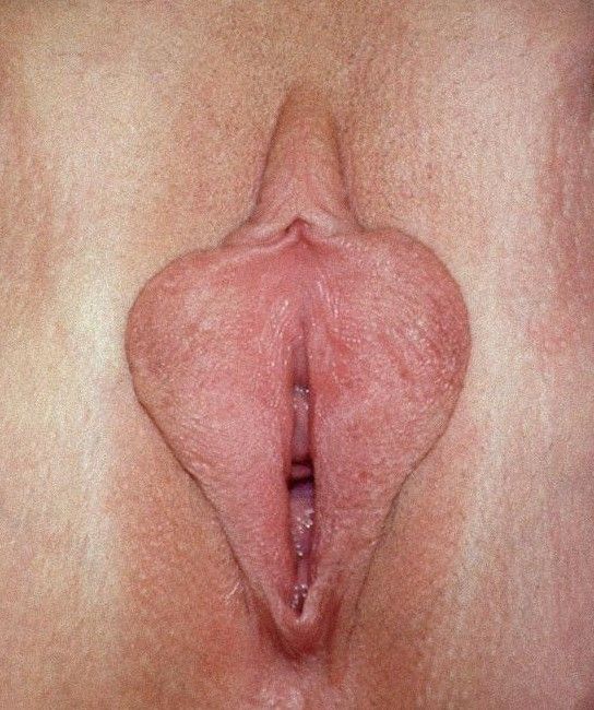labia
