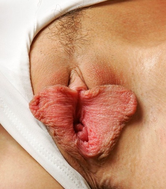 labia