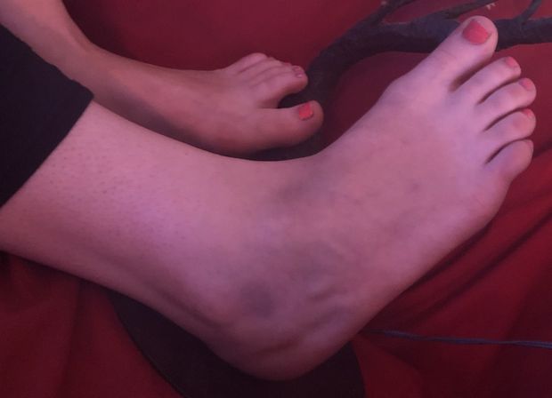 obsessed with her toes