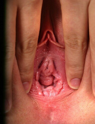 open