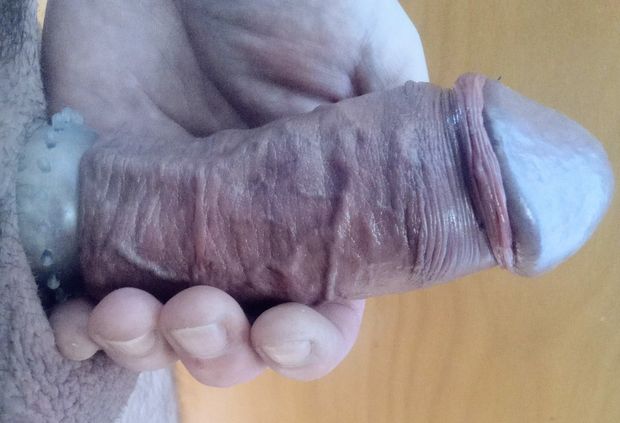 Erection ring