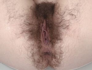 hairy holes