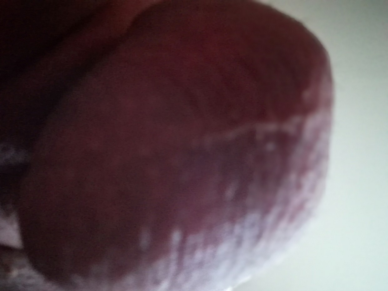 Me balls