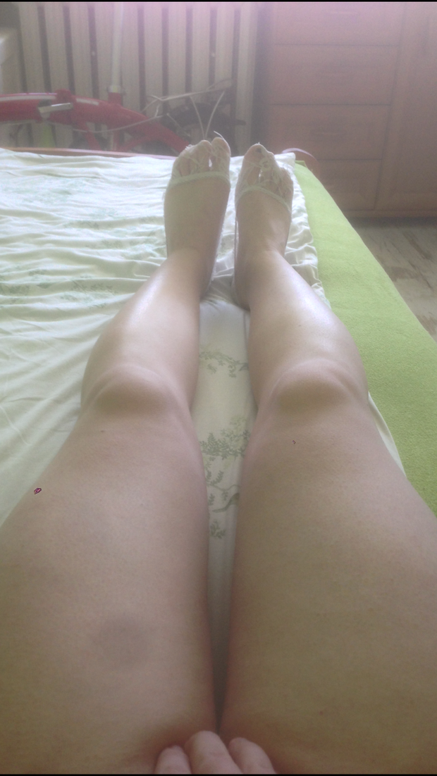 Legs