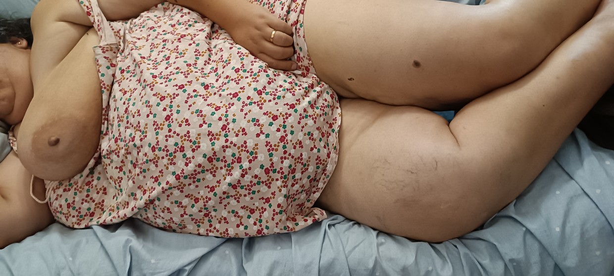 areolas